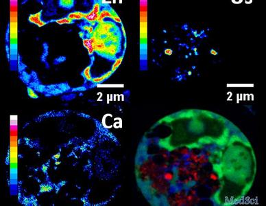 锇化合物 抗癌新发现：有机金属化合物锇可以从内部杀死肿瘤细胞