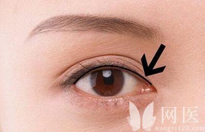 海岸线文学网 桃花运 来月经可以做美瞳线吗 做了美瞳线，桃花运就来！