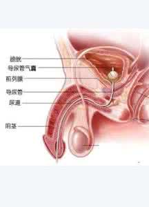 小便刺痛是什么原因 小便刺痛要紧吗 小便刺痛吃什么要？