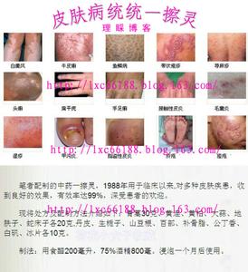 治皮肤病最灵的咒 各种皮肤病谁用谁灵!