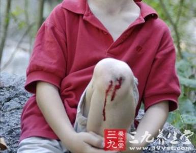 擦伤用什么消毒 皮肤擦伤消毒用什么