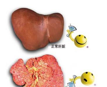 病毒性肝炎传播途径 病毒性肝炎十天根治