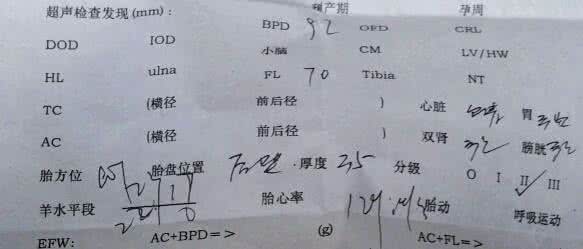 羊水少有什么症状 羊水少有什么症状？羊水少的五大症状