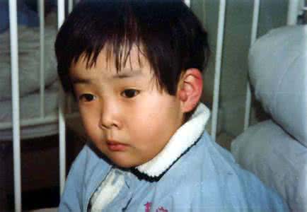 青黄不接打一生肖 中医望耳之山根青黄 耳前生瘤