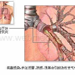 慢性支气管哮喘治疗 治慢性支气管哮喘秘方*