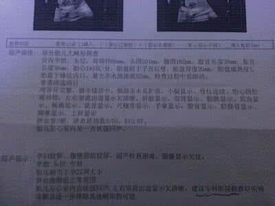 胎儿排畸检查时间 胎儿排畸检查有哪些 胎儿排畸检查不可忽视,这些检查你做了吗?