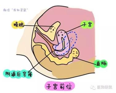 是子宫后位容易怀孕吗 子宫后位不易怀孕吗