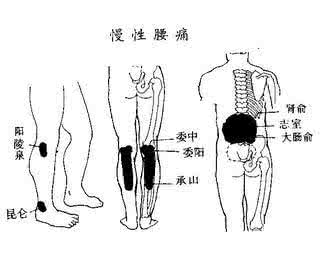 怀孕后腰痛 怀孕后腰痛的深度解析（详文收藏）