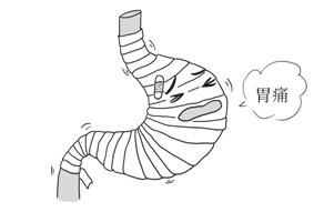 胃痛 呕吐物深褐色 1．为什么胃痛要忌食酸辣刺激之物