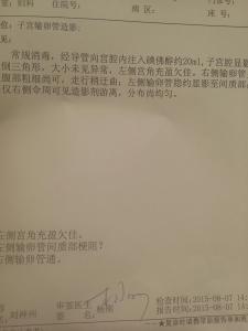 我想检查一下输卵管 关于输卵管检查 关于输卵管检查，你想知道的都在这了！