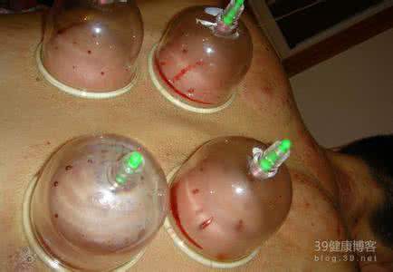 皮肤病清热解毒的中药 吃什么中药可以清血毒治好皮肤病