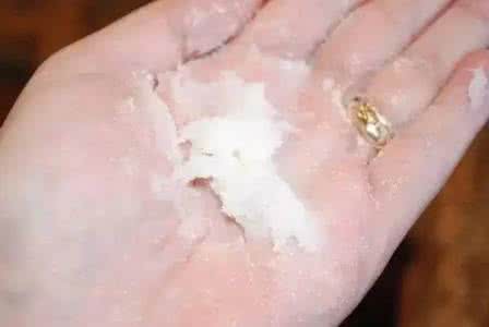 手脚粗糙怎么办 手脚粗糙怎么办 冬季手脚又干又糙?教你几招,让双手又白又嫩~