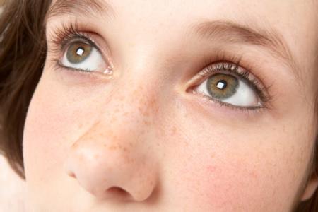 激光治疗斑点 脸上斑点 激光治疗脸上斑点是否会损害皮肤