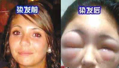 快过年了搞什么赚钱 快过年了搞什么赚钱 47岁女教师染发10天后身亡!快过年了,爱染发的赶快看