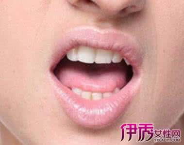 嘴唇上火起泡快速消除 嘴唇上火起泡快速消除 【嘴唇上火起泡怎么办】嘴唇起泡的处理办法