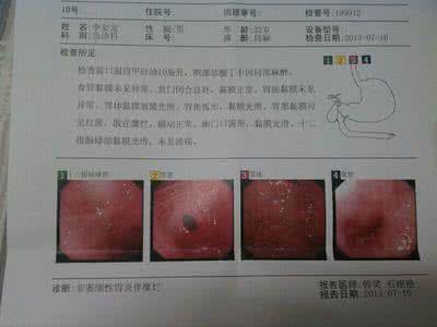 常见胃病症状 最常见的14个胃病症状