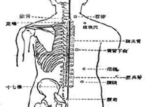棘突压痛 棘突叩痛
