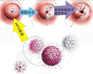 武汉鸣响防空警报 七大心脏病的早期症状 拉响健康“警报”