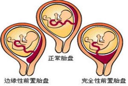 妈妈帮了解怀孕的常识 孕妈妈不得不知的数字常识