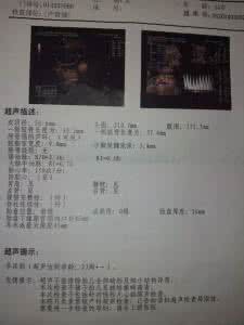 孕期排畸检查 孕期排畸检查 什么是孕期B超排畸检查 孕期排畸检查很重要