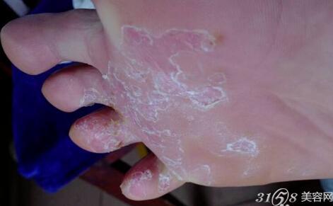 常见病验方选编 验方治疗： 奇病、怪病、常见病！