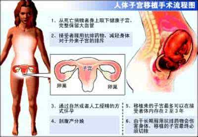 移植是放子宫哪个位置 子宫后位能做移植吗？