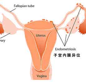 月经期为什么不能同房 专家详解 为什么月经期不能同房