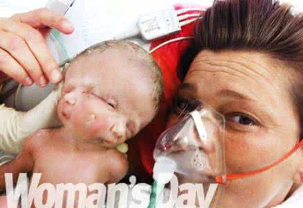 特灵娜生下女婴视频 特灵娜生下女婴视频 女子大出血生下畸形女婴，医生说原因竟是…