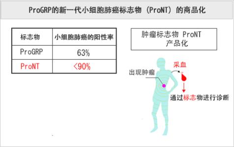 血液检测癌症 研究发现新方法：通过血液检测可以快速发现癌症！