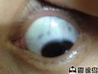 中医症状鉴别诊断学 《眼部症状的鉴别诊断 》