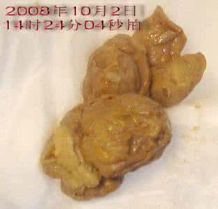 每天二次大便正常吗 大便每天二次是正常的吗