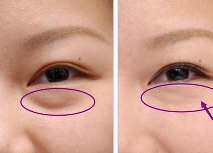 睡前读物 药店「不起眼」的便宜好物 女人睡前抹一点 抚平眼袋延缓衰老