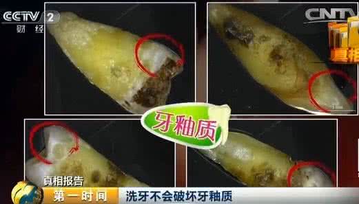 洗牙会破坏牙釉质吗 洗牙会不会破坏牙釉质呢?