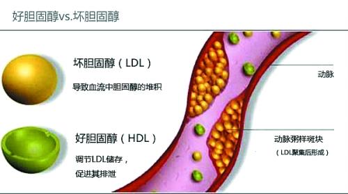 常见心血管疾病种类 5种常见心血管疾病的保健知识