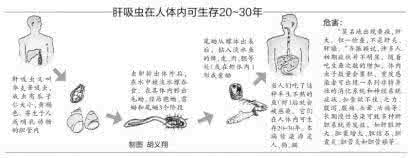 肝吸虫 我省肝吸虫病感染者发病排位靠前 喜食生鱼有关