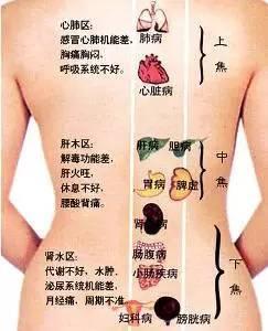 三焦经不通艾灸那里 三焦不通竟会出现这些疾病 你应该了解这些