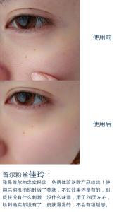 水杨酸去黑头 水杨酸去黑头 水杨酸大功效 3招赶走“黑头钉子户”