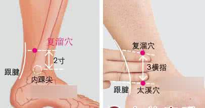 一型糖尿病治疗 一穴治疗糖尿病