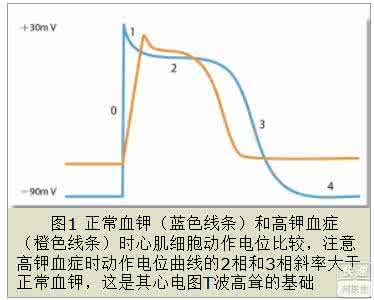引起高钾血症的原因 高钾血症 高钾血症是什么原因引起的