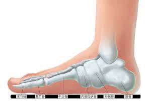 扁平足的矫正方法 扁平足的矫正方法 扁平足的治疗原则