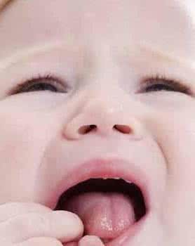 舌苔异常的症状有哪些 观察舌苔异常变化 及时调整饮食