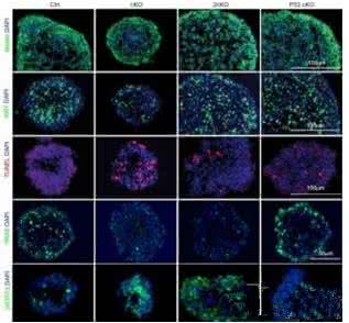 心血管期刊 Nature子刊鉴别出可控制心脏血管生长的关键蛋白