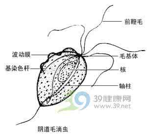 糖尿病的早期症状 阴道毛滴虫病症状 阴道毛滴虫病
