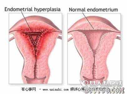 女人的月经周期 女人月经周期性的精神病
