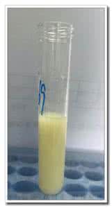 乳糜尿不治疗能自愈吗 乳糜尿