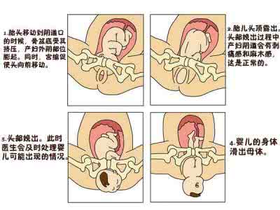 顺产对母亲的好处 顺产的好处
