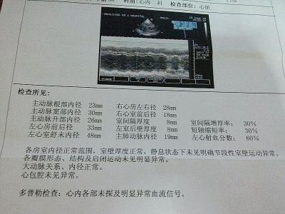 倍他乐克吃多久停药 吃倍他乐克什么时候停药呢 说明书上的逐步撤药是什么意思