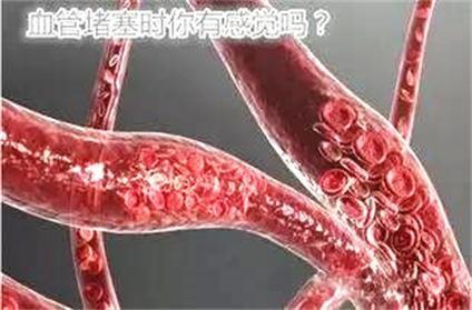 手背血管突出心脏不好 “血管操”练出好血管