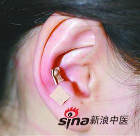 皮肤病奇效良方 神效奇方 --治皮肤溃疡、伤口久不愈合方