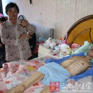 大肠癌 超过一半的大肠癌患者曾被误诊